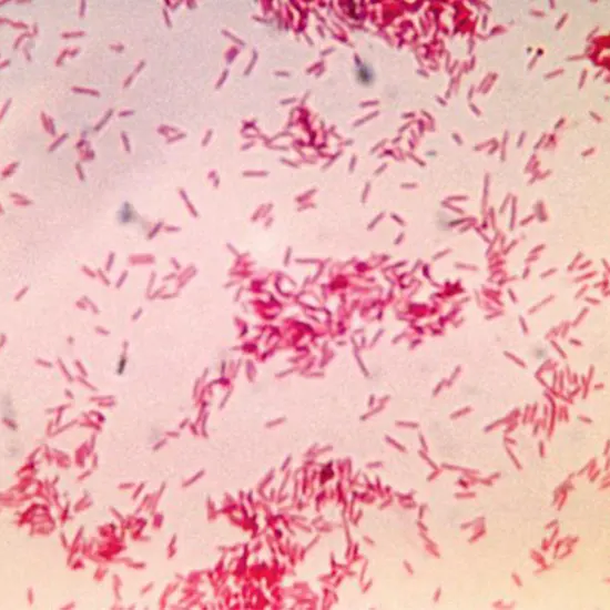 Fusobacterium : Culprit Behind Various Infections